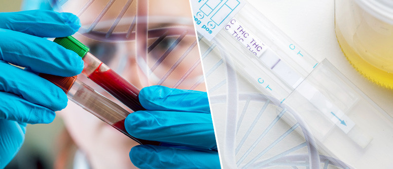Analyse du THC : test Sanguin, Urinaire et Salivaire